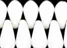 111-69-014 5x16mm 03000